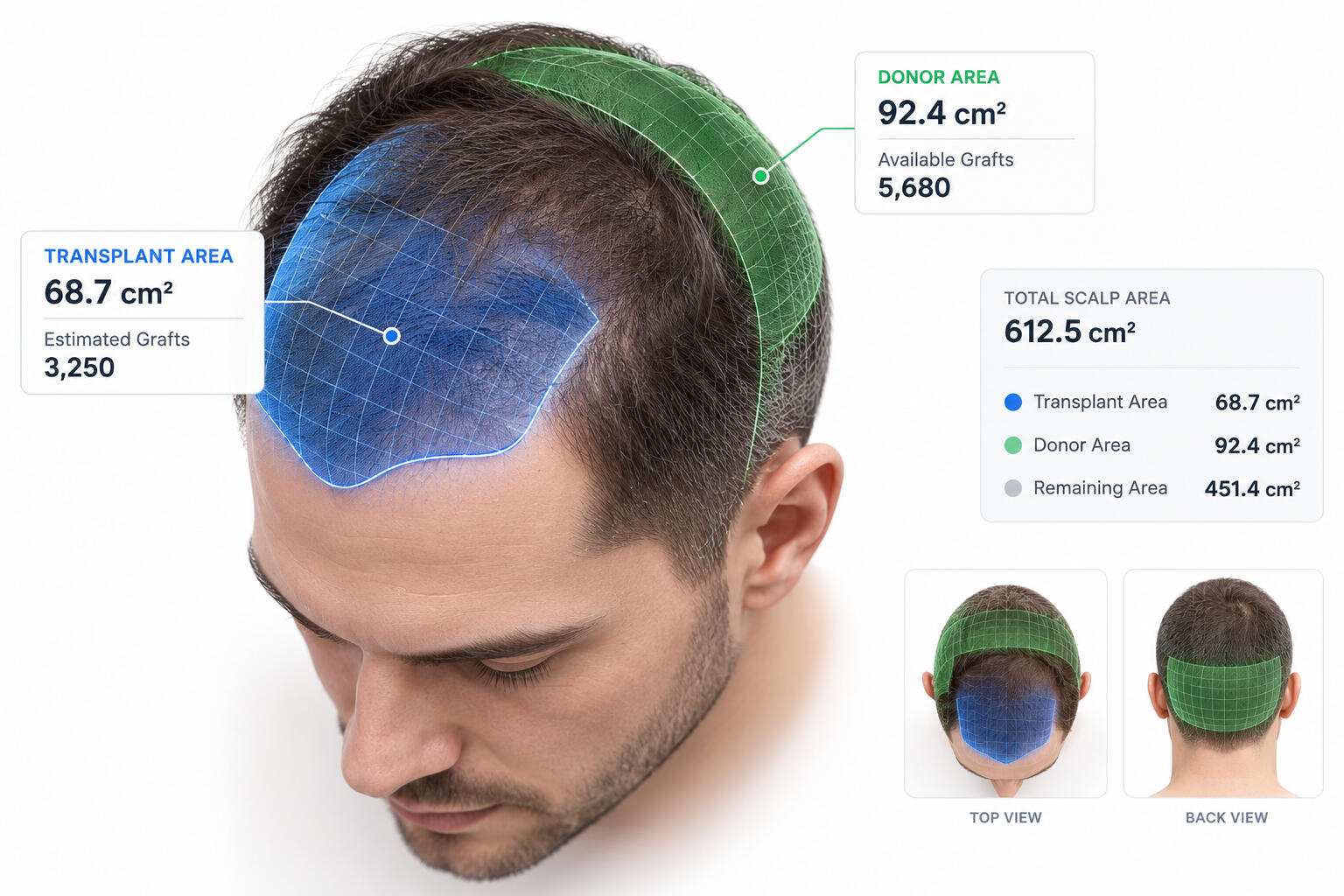 Full Hair Analysis
